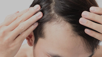 Thinning Hair in Men: Tips to Help Treat and Hide Hair Loss
