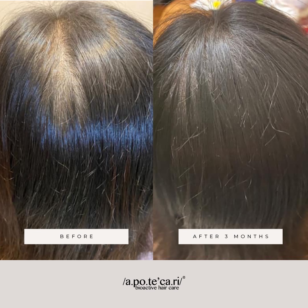Apotecari Mane Event for Intensive Hair Growth 3 months before after