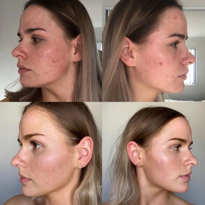 Eco Tan 3 Step Skincare System with Exfoliator before after results