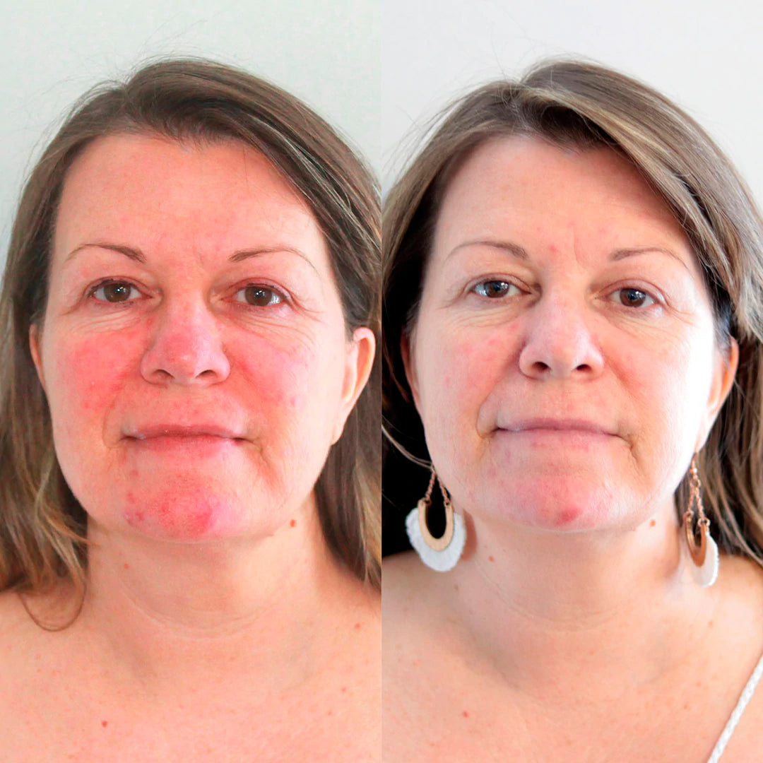 Eco Tan 3 Step Skincare System with Exfoliator before and after results