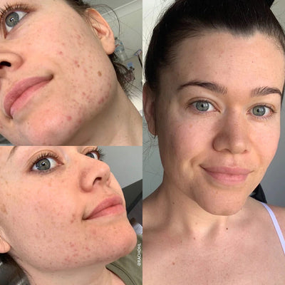 Eco Tan Hydration Skin System before and after results
