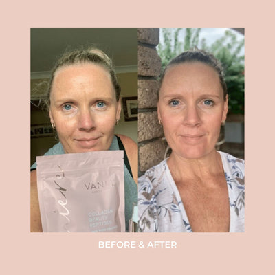 VANI-T Lumiere Collagen Peptides (250g) customer before after